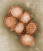   A/H1N1